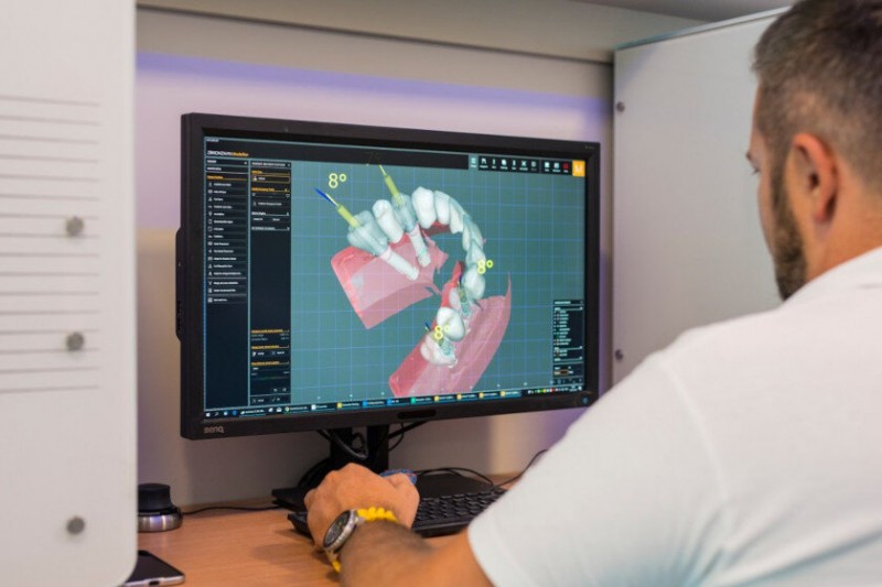 Computergestütztes 3D-Modell